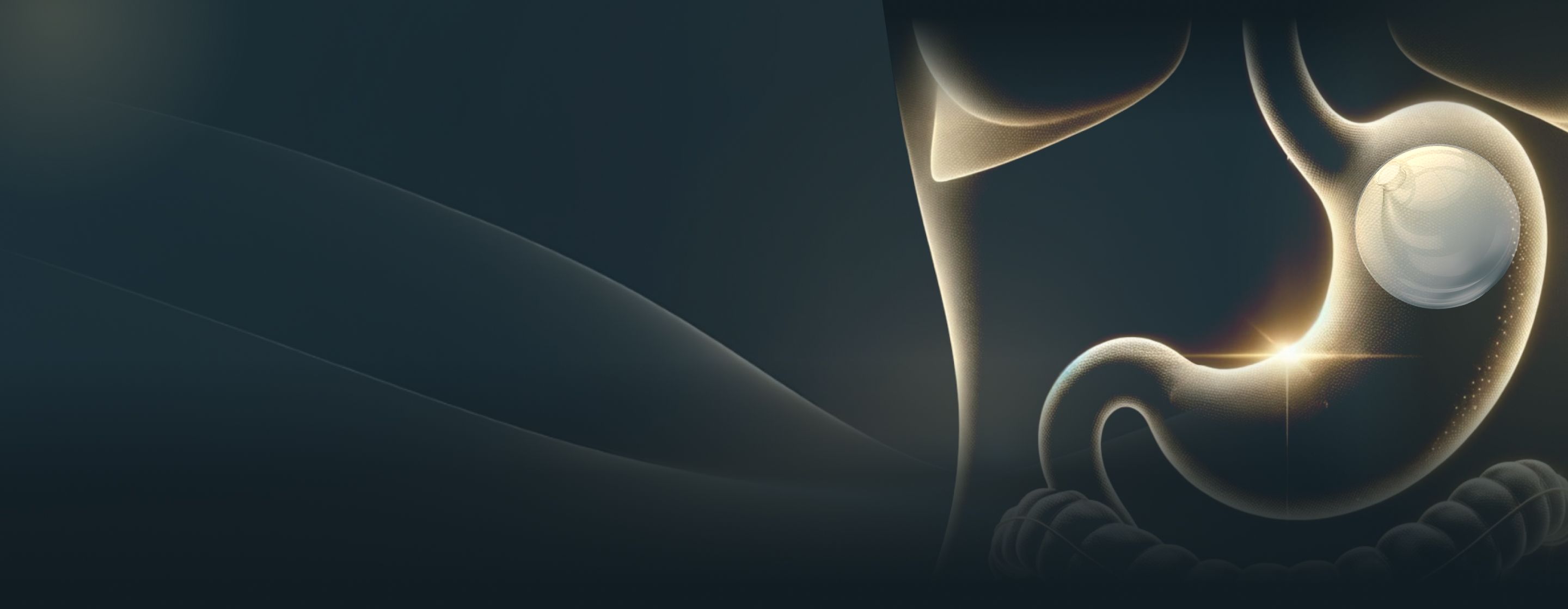 An illustration of a gastric balloon in a stomach