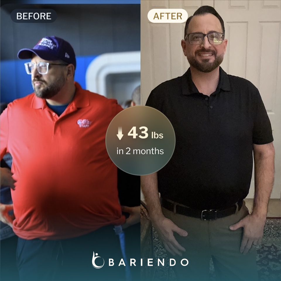 Joey lost 43 lbs with an ESG with Bariendo