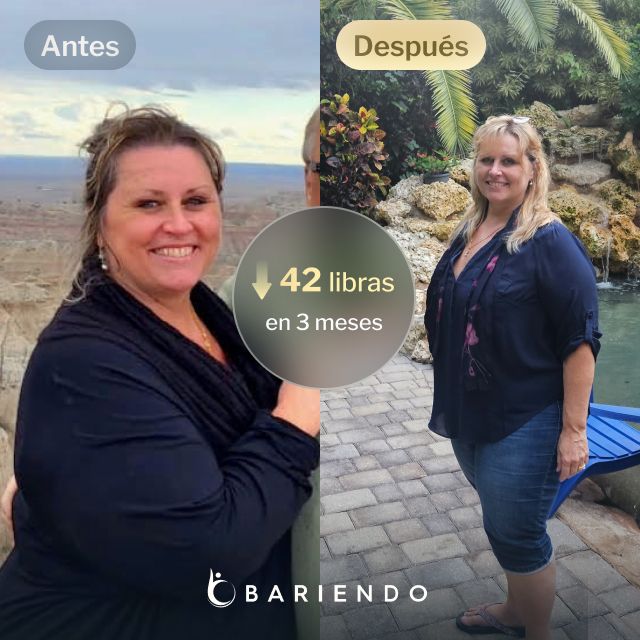 Imágenes de Lisa antes y después de perder 42 libras en 3 meses gracias a un procedimiento ESG