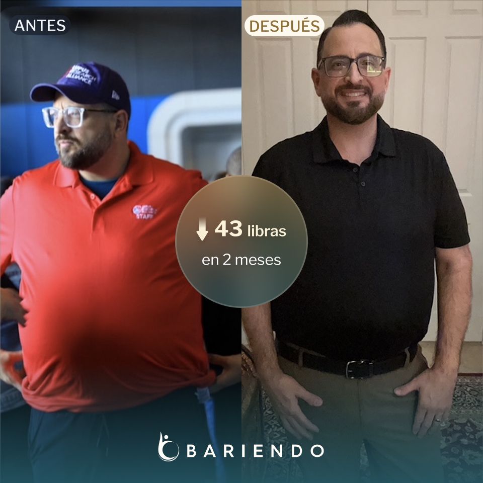 Joey lost 43 lbs with an ESG with Bariendo