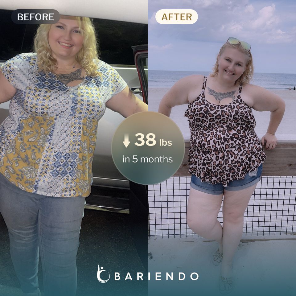 Cenedra lost 38 lbs in 5 months after an ESG procedure with Bariendo