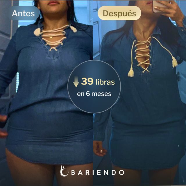 Imágenes de antes y después de Daniela, quien perdió 39 libras en 6 meses tras un balón gástrico con Bariendo.