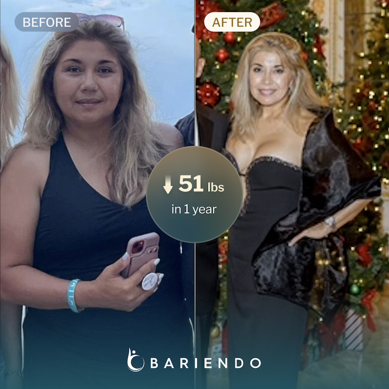 Before and after image of Amelia who lost 51 lbs with ESG