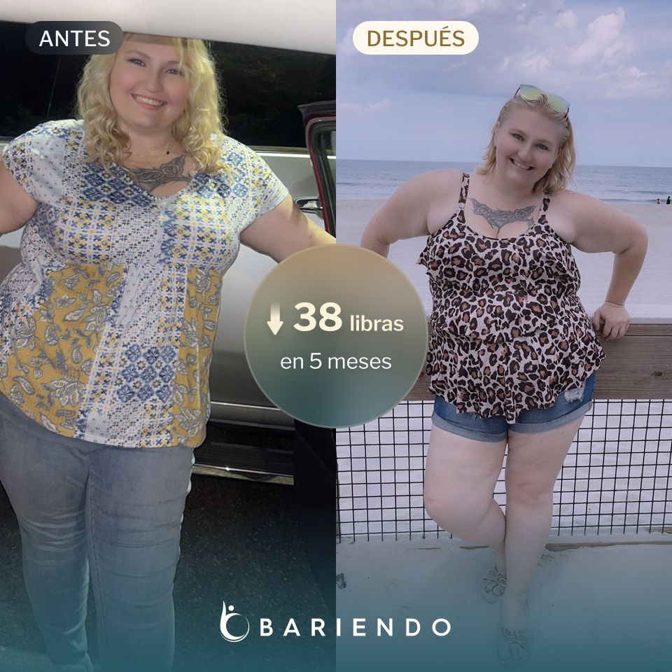 Cenedra perdió 38 libras con un ESG con Bariendo