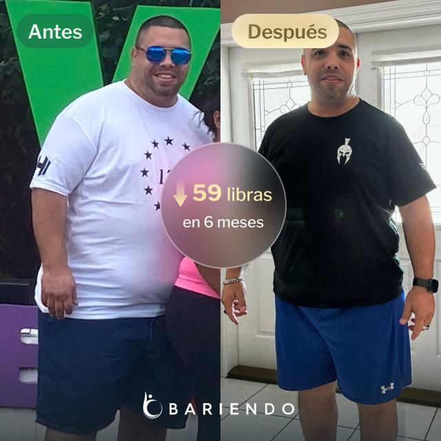 Imágenes de antes y después de Oscar, quien perdió 59 libras en 6 meses a través del procedimiento de Reducción de Estómago ESG de Bariendo.