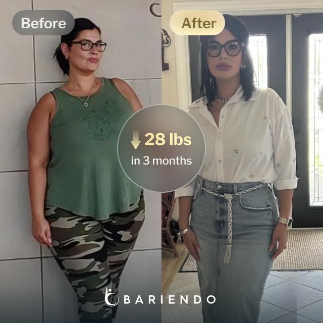 Before and after images of Candy who lost 28 pounds in 3 month through Bariendo's ESG Stomach Tightening® procedure