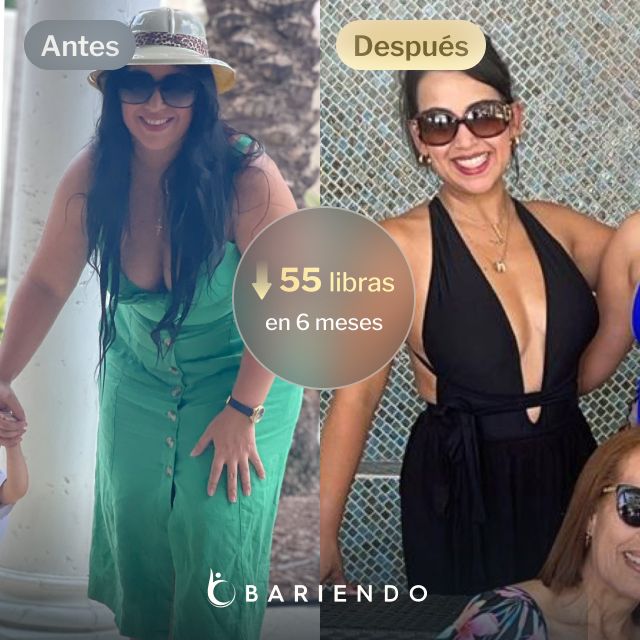 Imágenes de antes y después de Anaís, quien perdió 55 libras en 6 meses tras un balón gástrico con Bariendo.