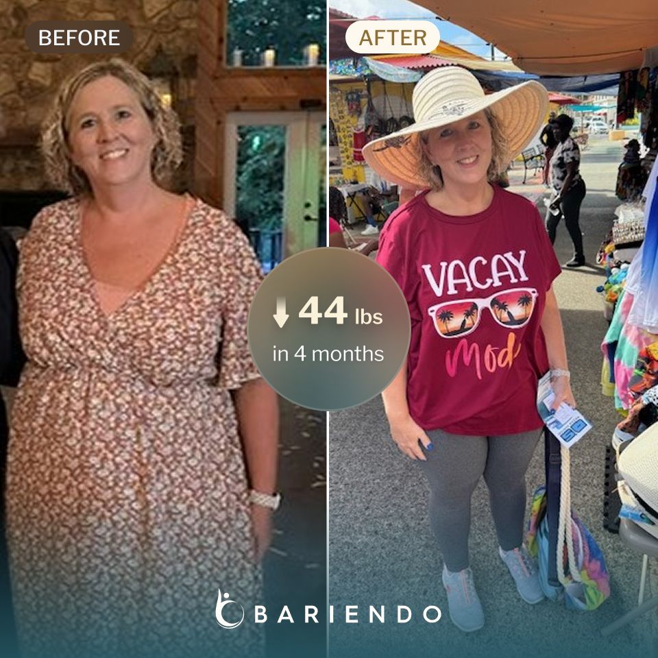 Christina before and after