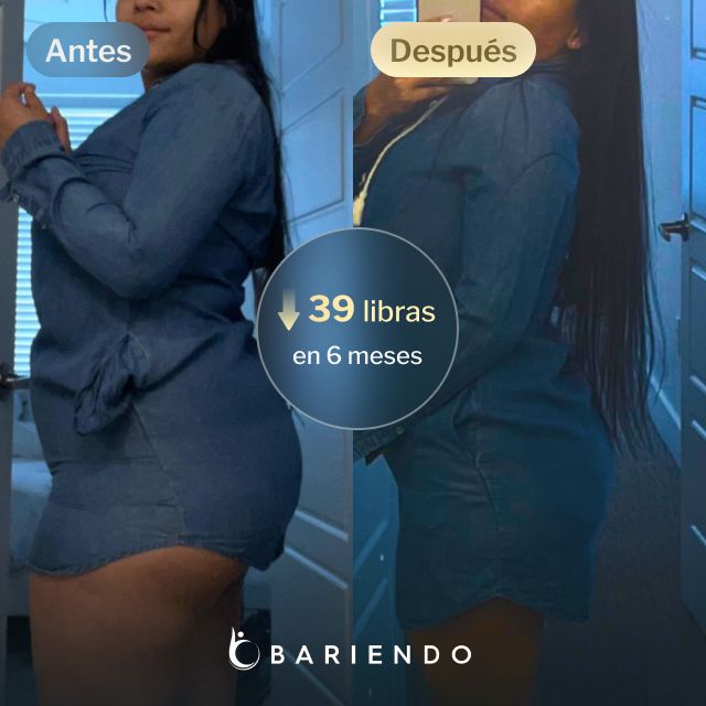 Imágenes de antes y después de Daniela, quien perdió 39 libras en 6 meses tras un balón gástrico con Bariendo.