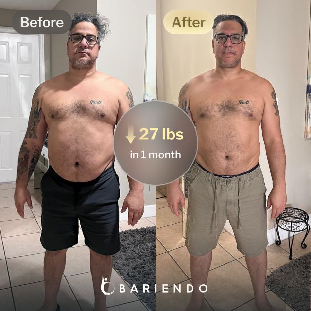 Before and after images of Cesar who lost 27 pounds in 1 month through Bariendo's ESG Stomach Tightening® procedure