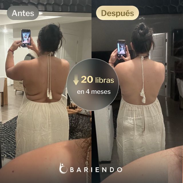 Imagen del antes y después de Ruxibeth que perdió 20 libras en 4 meses con un procedimiento de balón gástrico