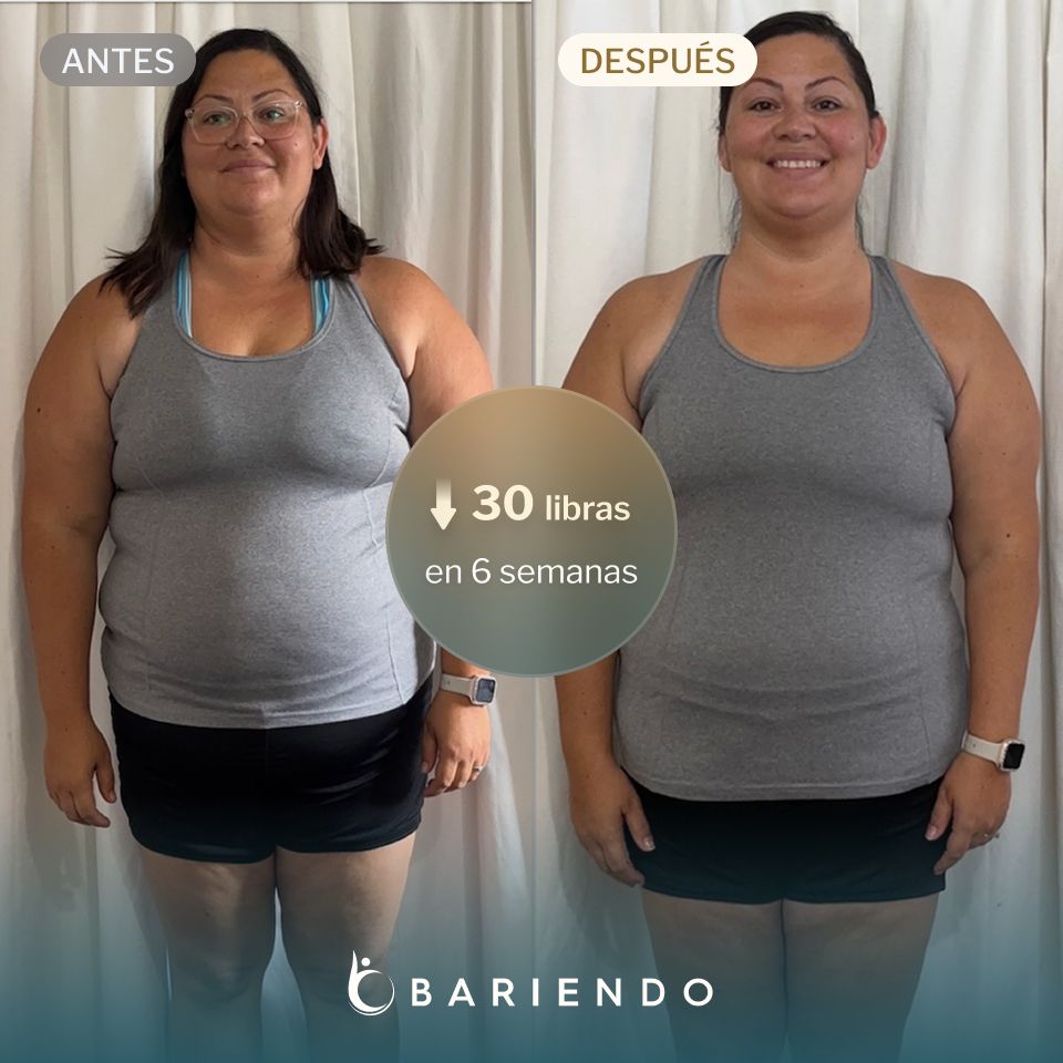 Lacy perdió 30 libras con ESG de Bariendo