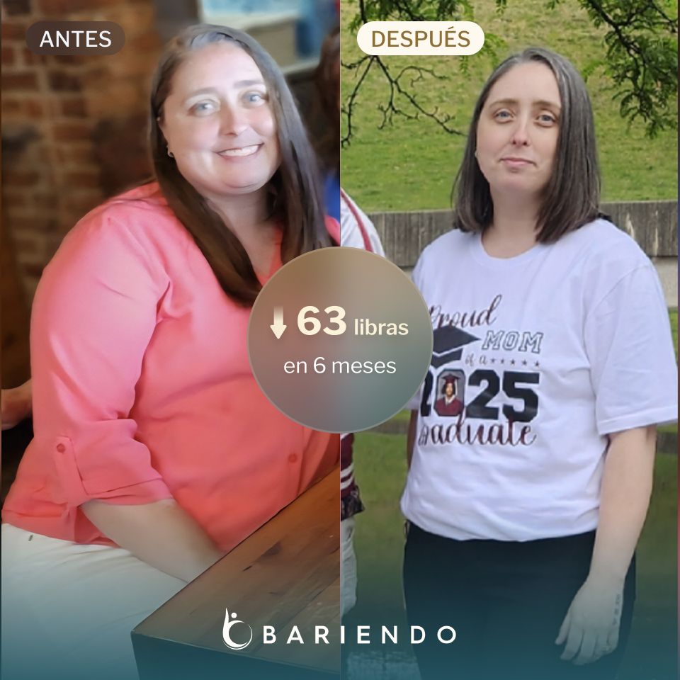 Helen tuvo un nuevo comienzo y perdió 63 libras con un ESG de Bariendo