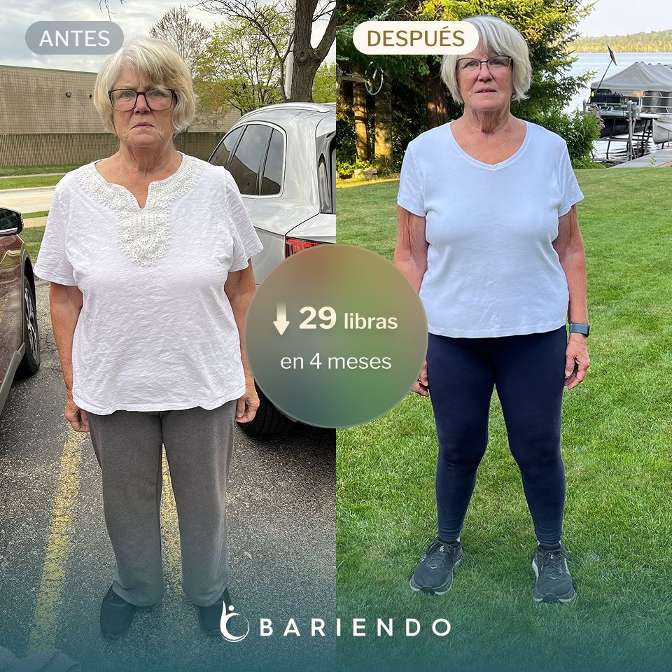 Karen perdió 29 libras con un ESG de Bariendo