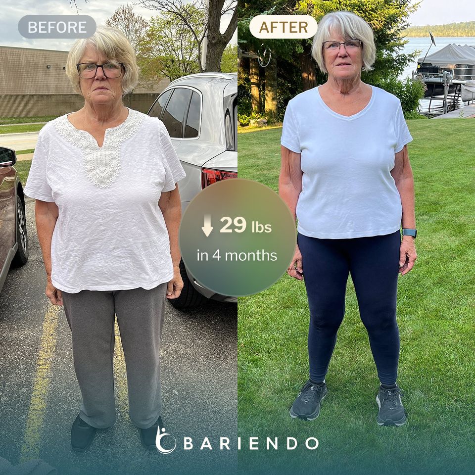 Karen lost 29 pounds after an ESG with Bariendo